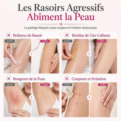 Épilation Douce et en Douceur du Corps Avec un Roll-on